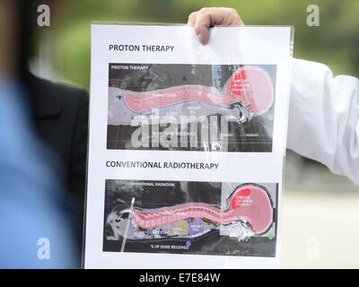 Prag, Tschechische Republik. 15. Sep, 2014. Britische junge Ashya König wurde die erste einer Reihe von 30 Gehirn Tumor Proton Strahl Behandlungen seinen Gehirntumor bei Protonentherapie-Zentrum in Prag, Tschechische Republik, 15. September 2014. Abgebildete Kopf des klinischen Physik Vladimir Vondracek erklärt den Unterschied zwischen Proton Strahl Behandlung und konventionelle Strahlentherapie. Bildnachweis: CTK/Alamy Live-Nachrichten Stockfoto