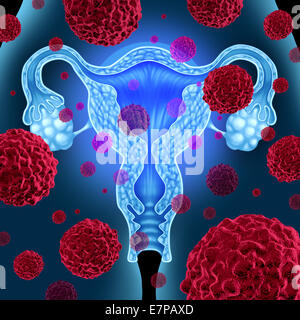 Gebärmutter oder Gebärmutterkrebs medizinisches Konzept als Krebszellen in einem weiblichen Körper angreifen der Geschlechtsorgane-Anatomie einschließlich der Eierstöcke und Eileiter als Gesundheitswesen Symbol der zervikalen Tumorbehandlung Wachstum und Risiken zu verbreiten. Stockfoto