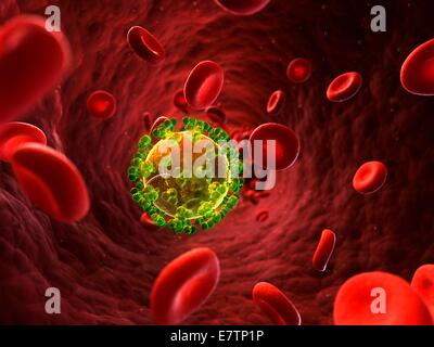 HIV (Human Immunodeficiency Virus) Infektion, Computer-Grafik. Stockfoto