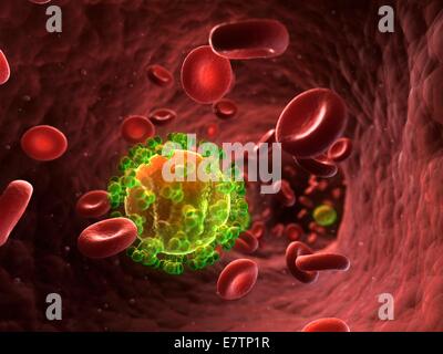 HIV (Human Immunodeficiency Virus) Infektion, Computer-Grafik. Stockfoto