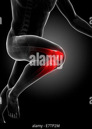 Menschliche Anatomie Kunstwerk ein Läufer Knie Gelenk, Computer. Stockfoto