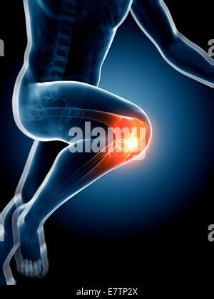 Menschliche Anatomie Kunstwerk ein Läufer Knie Gelenk, Computer. Stockfoto