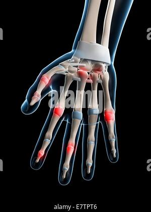 Menschlichen Fingergelenke, Computer-Grafik. Stockfoto