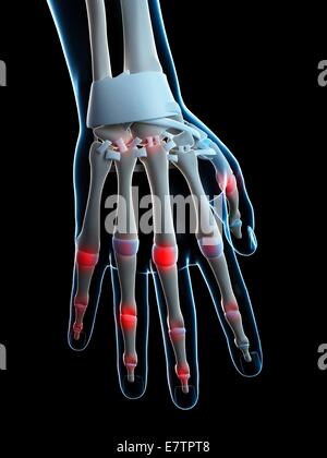 Menschliche Finger. Licht Schliffbild einen Längsschnitt durch einen Finger  eines menschlichen Kindes. Dies zeigt die Knochen in den Finger (hier sind  die 1. und Stockfotografie - Alamy