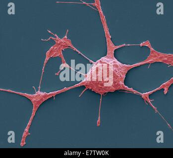 Neurone. Scanning Electron Schliffbild (SEM) von einem PC12 Neurone in Kultur. PC12 Zelllinie, entwickelt von einem Phäochromozytom Tumor von der Ratte Nebennierenmark, ist eine Premiere Modell für die Untersuchung der neuronalen Differenzierung geworden. Wenn Kultur behandelt Stockfoto