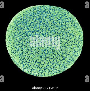Orbulina. Farbige Scan Elektron Schliffbild (SEM) der Schale von der Foraminiferan sind Orbulina SP. Foraminiferans marine einzelligen Protisten, die bauen und bewohnen Schalen (Tests), die aus mehreren Kammern bestehen. Sie sind eines der ol Stockfoto