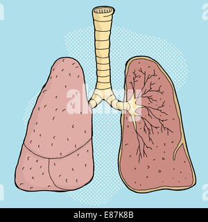 Karikatur der menschlichen Lunge mit Querschnitt Lappen Stockfoto