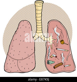 Verschiedene süchtig Tabak Objekte innerhalb der menschlichen Lunge Stockfoto