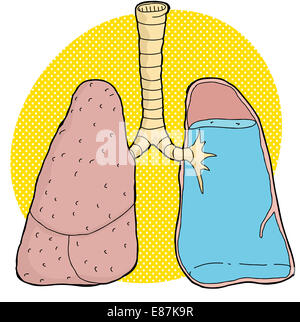 Lungen mit Wasser innen auf gelbem Hintergrund Stockfoto