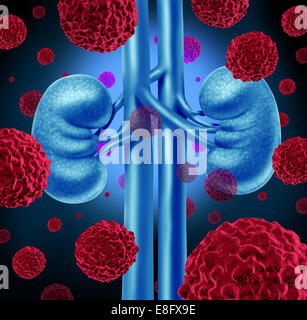 Niere Krebs medizinisches Konzept als Krebszellen in einem menschlichen Körper Angriff auf die Harnwege und Nieren Anatomie als Symbol für Stockfoto