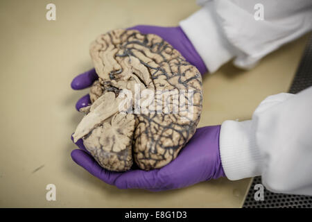 Menschliches Gehirn sezieren für medizinischen Test Demenz Stockfoto