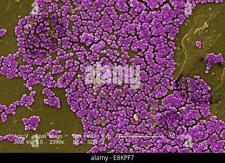 Dieser eingefärbte scanning Electron Schliffbild (SEM) dargestellt, zahlreiche Klumpen von Methicillin-resistenten Staphylococcus aureus Stockfoto