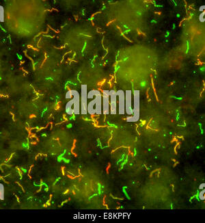 Lyme-Borreliose Bakterien, Borrelia Burgdorferi Lyme Krankheit Spirochete, Borrelia Burgdorferi ist eine obligate Parasiten, die Zyklen Stockfoto