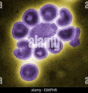 Dieser eingefärbte negativ gefärbten Transmission Electron Schliffbild (TEM) zeigt Ultrastrukturforschung Angabe der influenza Stockfoto