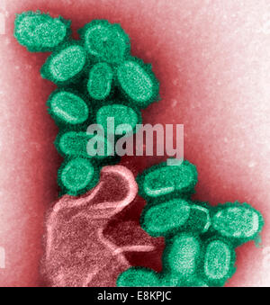 Dieser eingefärbte negativ gefärbten Transmission Electron Schliffbild (TEM) zeigt nachgebildeten 1918 Grippe Virionen, die waren Stockfoto
