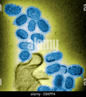 Dieser eingefärbte negativ gefärbten Transmission Electron Schliffbild (TEM) zeigt nachgebildeten 1918 Grippe Virionen, die waren Stockfoto