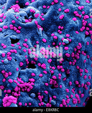 Eingefärbte scanning Electron Schliffbild der Middle Eastern respiratorische Syndrom Virus-Partikel an der Oberfläche befestigt ein Stockfoto