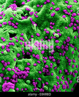 Eingefärbte scanning Electron Schliffbild der Middle Eastern respiratorische Syndrom Virus-Partikel an der Oberfläche befestigt ein Stockfoto