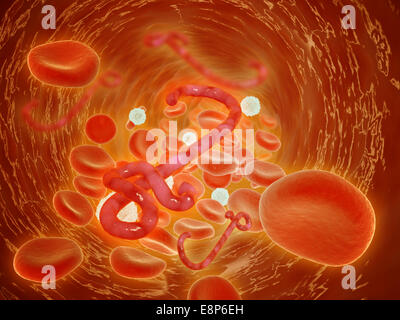 Konzeptbild des Ebola-Virus in Arterie. Stockfoto