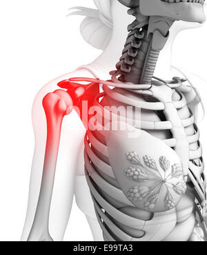 Illustration der Schulter Schmerzen Kunstwerk Stockfoto