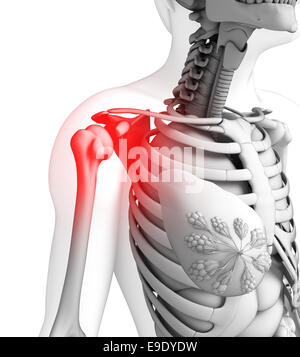 Illustration der Schulter Schmerzen Kunstwerk Stockfoto