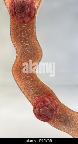 Darm-Untersuchung hautnah Stockfoto