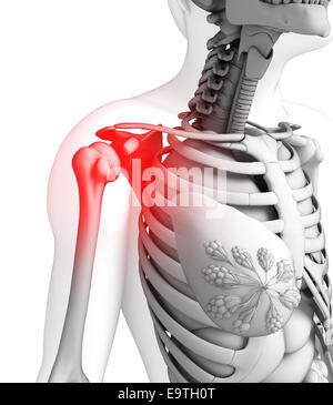 Illustration der Schulter Schmerzen Kunstwerk Stockfoto