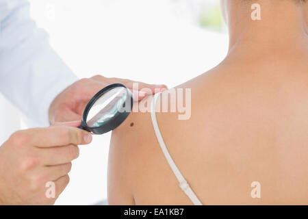 Arzt untersuchen Melanom auf Frau Stockfoto