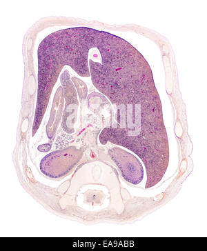 Menschlichen Fötus Thorax befleckt Abschnitt zeigt allgemeine Strukturen Stockfoto