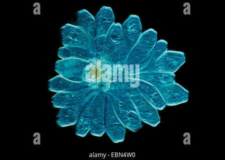 Vorticella (Vorticella spec.), differential Interferenz-Kontrast Stockfoto