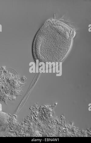 Vorticella (Vorticella spec.), differential Interferenz-Kontrast Stockfoto