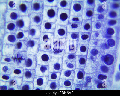 Garten-Zwiebel, Birne Zwiebel, gemeinsame Zwiebel (Allium Cepa), Mitose in Celles der Wurzelspitze einer Zwiebel, 1000 X Stockfoto
