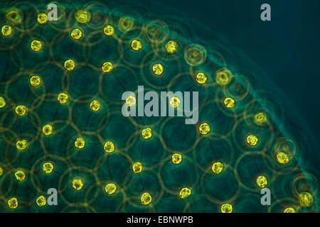 Volvox Aureus (Volvox Aureus), im Phasenkontrast und Interferenz Kontrast, detail Stockfoto