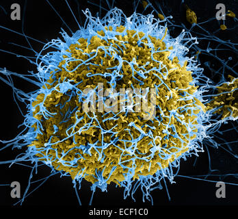 Eingefärbte scanning Electron Schliffbild von filamentösen Ebola-Virus-Partikel (blau) angehende von chronisch infizierten VERO E6 c Stockfoto