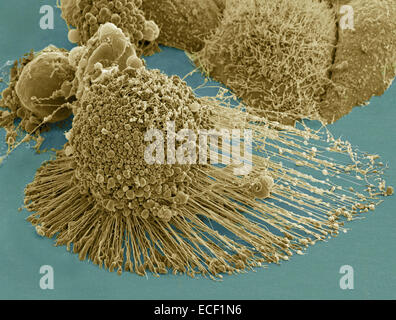 Scanning Electron Schliffbild der eine apoptotische HeLa-Zelle. Zeiss Merlin HR-SEM. Stockfoto