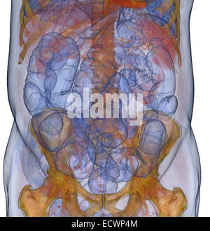 3D CT-Scan Bild eines CT-Koloskopie-Verfahrens. Stockfoto