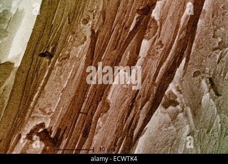 Scanning Electron Schliffbild von Chrysotilasbest, weiß. Stockfoto