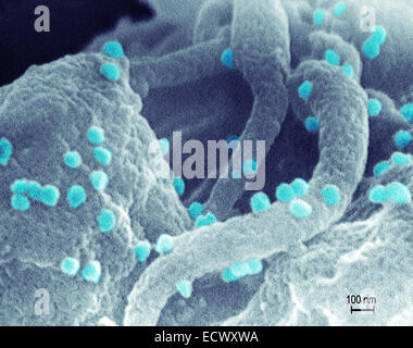 Scanning Electron Schliffbild von HIV. Stockfoto