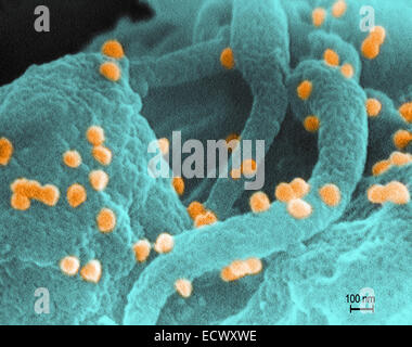 Scanning Electron Schliffbild von HIV. Stockfoto