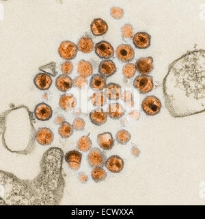 Elektron Schliffbild des Human Immunodeficiency Virus, HIV. Stockfoto