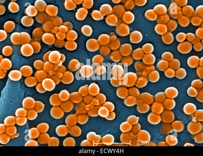 Scanning Electron Schliffbild der MRSA-Bakterien. Stockfoto