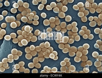 Scanning Electron Schliffbild der MRSA-Bakterien. Stockfoto