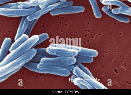 Scanning Electron Schliffbild der Tuberkulose-Bakterien. Stockfoto