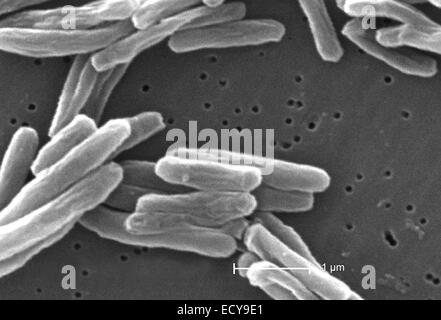 Scanning Electron Schliffbild der Tuberkulose-Bakterien. Stockfoto