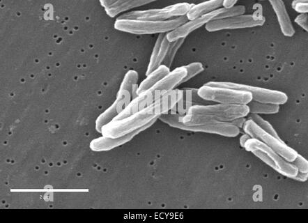 Scanning Electron Schliffbild der Tuberkulose-Bakterien. Stockfoto