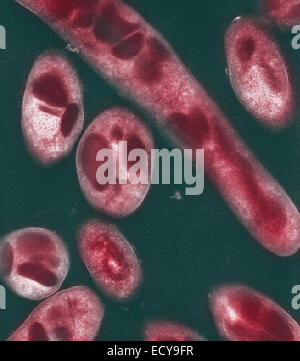 Mikrophotographie von Bacillus Anthracis (Milzbrand) Sporen. Stockfoto