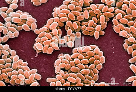 Mikrophotographie von Bacillus Anthracis (Milzbrand) Sporen. Stockfoto