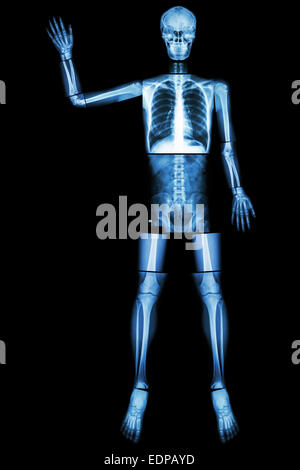 Good Bye EBOLA. (Menschliche Knochen Welle der Hand) (Ganzer Körper: Kopf Hals Wirbelsäule Schulter Arm Ellenbogen Unterarm Handgelenk Hand Finger Thorax Hea Stockfoto