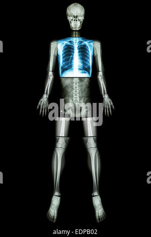 Gesunde Lunge (Röntgen-Ganzkörper: Schädel Kopf Hals Wirbelsäule Schulter Brust Thorax Lunge Lunge Herz Rippe Arm Ellenbogen Unterarm Handgelenk ha Stockfoto