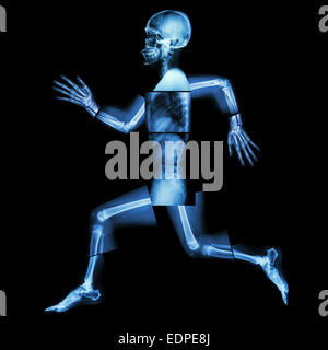 Aerobic-Übungen (menschliche Knochen läuft), (Ganzkörper Röntgen: Kopf, Hals, Schulter, Schulter, arm, Ellenbogen, Unterarm, hand, finger Stockfoto